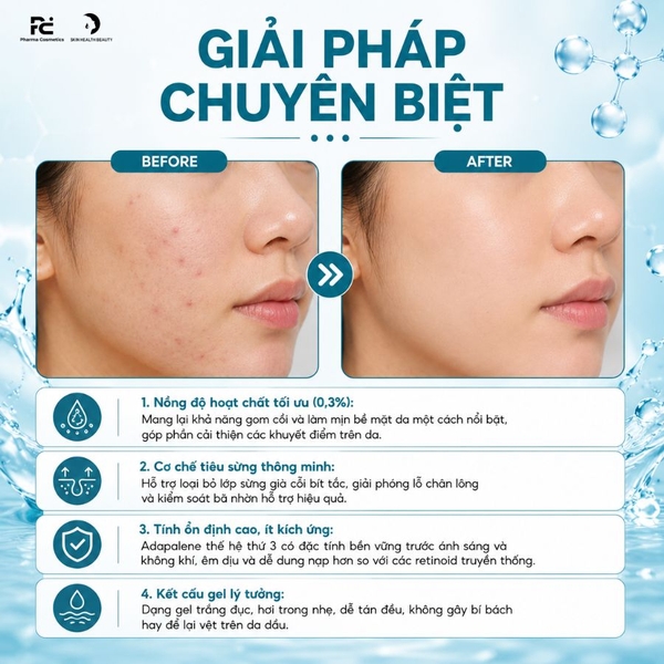 Klena Forte 0,3 15g – Gel Chuyên Biệt Giúp Giảm Mụn, Tiêu Cồi Và Ngăn Ngừa Mụn Tái Phát
