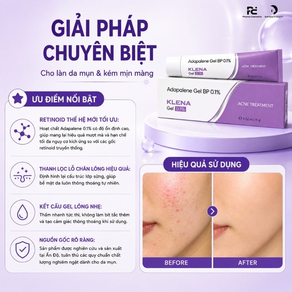 Klena Gel Adapalene 0.1% – Gel Bôi Nhẹ Dịu Giúp Giảm Mụn Và Làm Mịn Bề Mặt Da