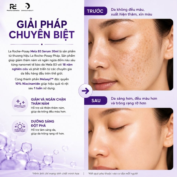 LA ROCHE POSAY PURE MELA B3 SERUM / TINH CHẤT DƯỠNG DA GIÚP MỜ THÂM NÁM, TRẮNG DA
