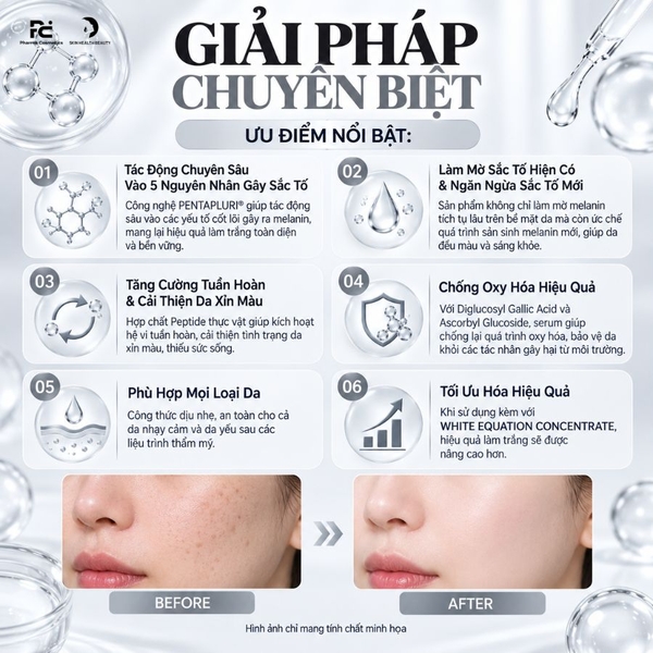 MONA FREMA WHITE-EQUATION COMPLEX SERUM: Tinh Chất Dưỡng Trắng & Cải Thiện Sắc Tố Da Chuyên Sâu