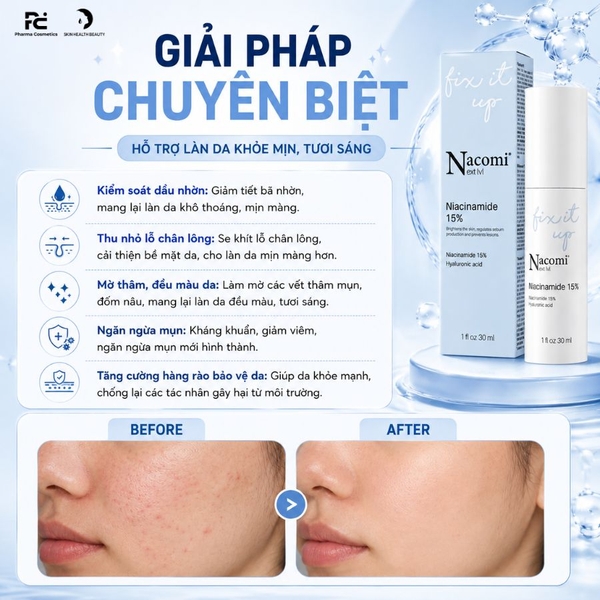 NACOMI NEXT LEVEL NIACINAMIDE 15% / HUYẾT THANH KIỂM SOÁT NHỜN, THU NHỎ LỖ CHÂN LÔNG, TẠM BIỆT MỤN VÀ THÂM