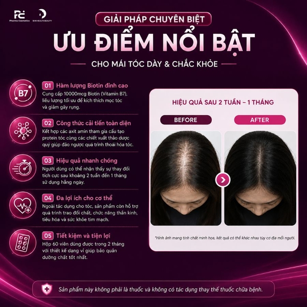 Nanofall Hair Supplement: Viên Uống Mọc Tóc Bản Cải Tiến Với Biotin 10000mcg – Giải Pháp Cho Mái Tóc Dày Khỏe