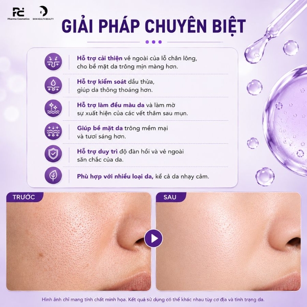 Paula's Choice Clinical Niacinamide 20% Treatment: Tinh Chất Thu Nhỏ Lỗ Chân Lông & Sáng Mịn Bề Mặt Da