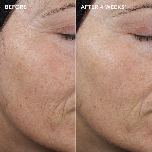 IMAGE Skincare AGELESS+ Retinol Pure Liquid Retinol 0.3% – Serum retinol dành cho da đã thích nghi da hỗn hợp, da dầu