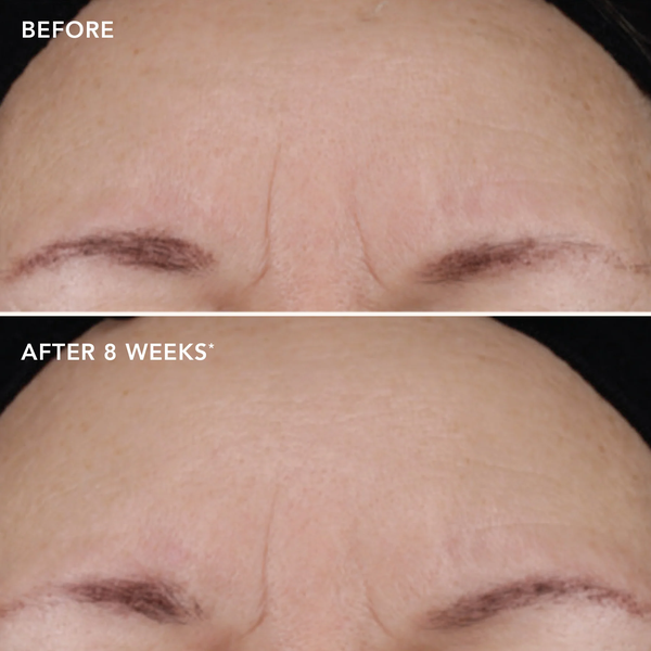 IMAGE Skincare AGELESS+ Retinol Treatment Crème 1.2% Retinol Complex – Kem retinol nồng độ cao chống lão hóa chuyên sâu