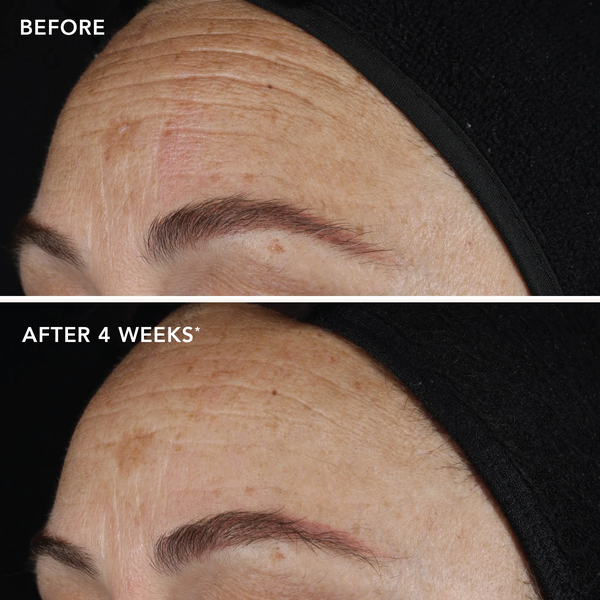 IMAGE Skincare AGELESS+ Retinol Pure Liquid Retinol 0.1%: Serum retinol tinh khiết 0.1% dành cho người mới bắt đầu, da nhạy cảm hoặc da hỗ hợp.