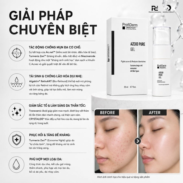 PROFIDERM AZEXO PURE GEL: Gel Đặc Trị Mụn & Sắc Tố - Kháng Khuẩn, Phục Hồi & Làm Sáng Da Đột Phá