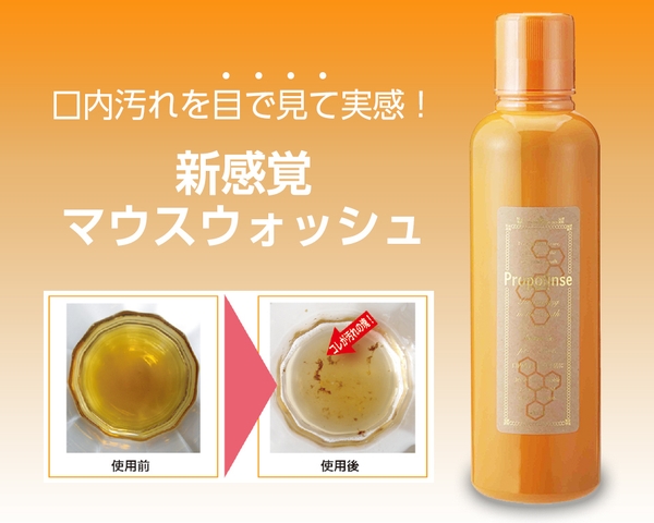 PROPOLINSE PURE: Nước Súc Miệng Sạch Mảng Bám, Cho Hơi Thở Thơm Mát Dài Lâu