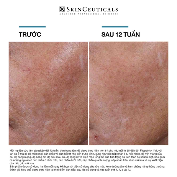 SKINCEUTICALS HYALURONIC ACID INTENSIFIER: Tinh Chất Tăng Cường Độ Ẩm & Săn Chắc Da