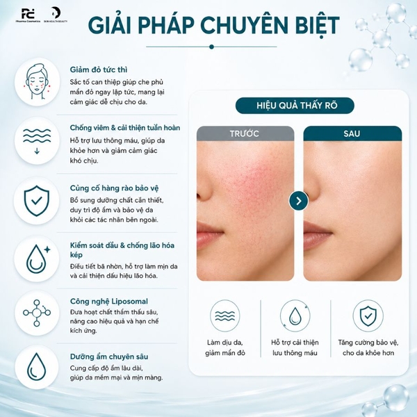 SESDERMA AZELAC MOISTURIZING FACIAL CREAM: Kem Dưỡng Đặc Trị Đỏ Da, Trứng Cá Đỏ & Lão Hóa
