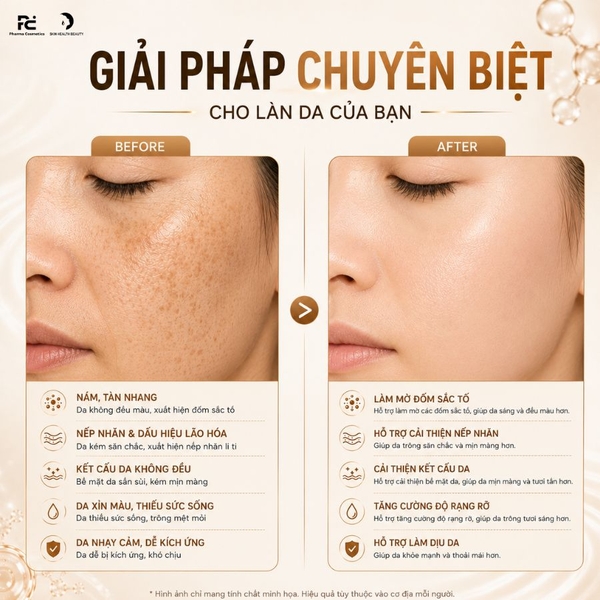 SESDERMA AZELAC RU GEL CREAM: Kem Gel Đặc Trị Nám, Giảm Nhăn & Trẻ Hóa Da Công Nghệ Liposomal