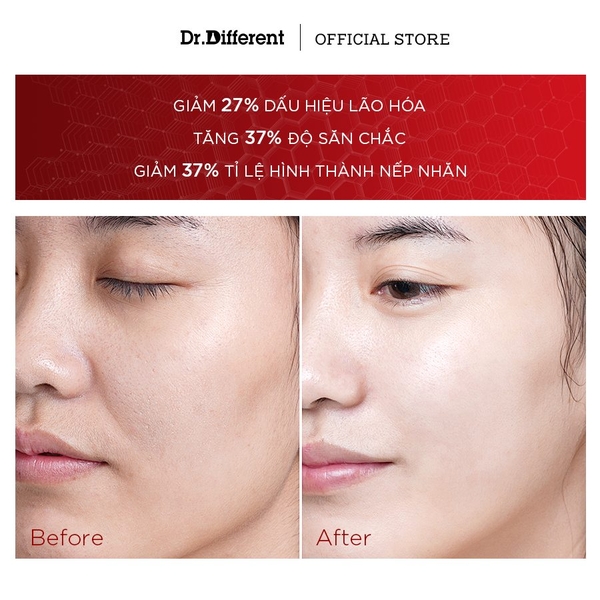 Dr.Different CEQ Anti-Oxidant Serum – Tinh Chất Phức Hợp Vitamin C 15%, E Và CoQ10 Hỗ Trợ Dưỡng Sáng, Làm Mờ Thâm Sạm Và Tăng Độ Đàn Hồi