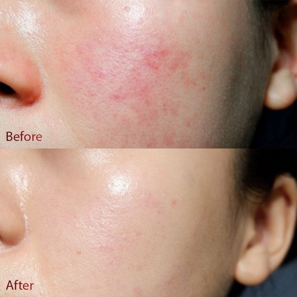 DR.DIFFERENT HYALURON COOL SOOTHING CREAM / KEM DƯỠNG ẨM VÀ LÀM DỊU DA TỨC THÌ 