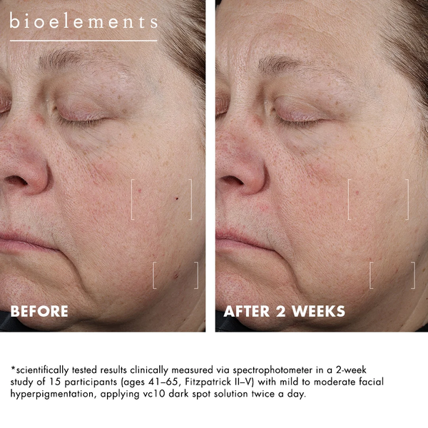 Bioelements VC10 Dark Spot Solution – Kem chấm Vitamin C 10% hỗ trợ cải thiện đốm nâu và tăng sắc tố