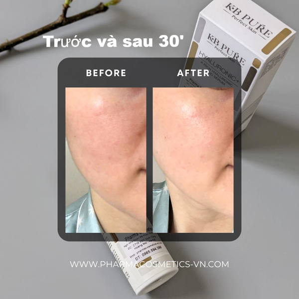 KB PURE HYALURONIC+ SERUM HA: Huyết Thanh Siêu Cấp Ẩm & Phục Hồi Sức Sống Cho Làn Da