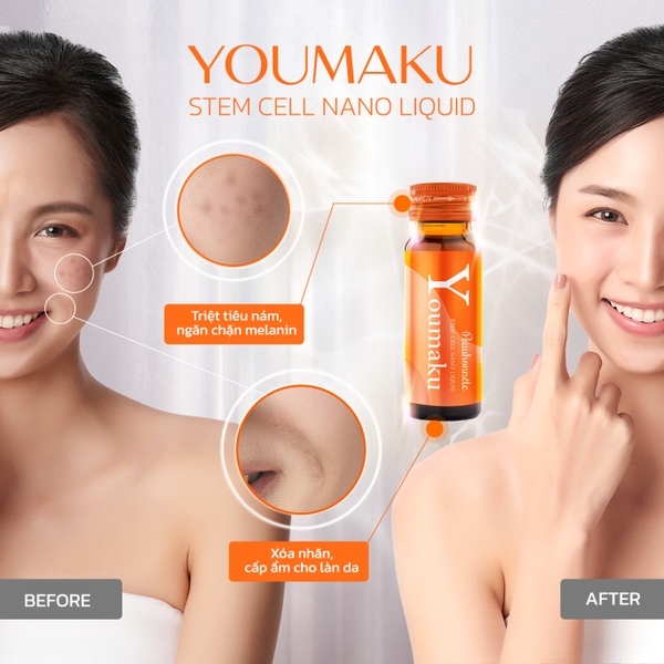 PEAUHONNETE YOUMAKU STEM CELL NANO LIQUID / NƯỚC UỐNG TRẮNG DA VÀ GIẢM CÂN