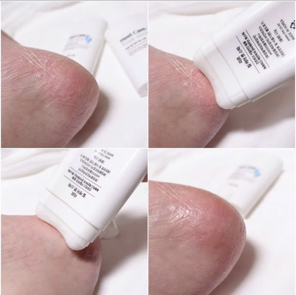 HEEL CARE FOOT STICK / THANH LĂN DẠNG THỎI CHĂM SÓC GÓT CHÂN, GIÚP LÀM MỀM VÀ GIẢM NỨT NẺ GÓT CHÂN