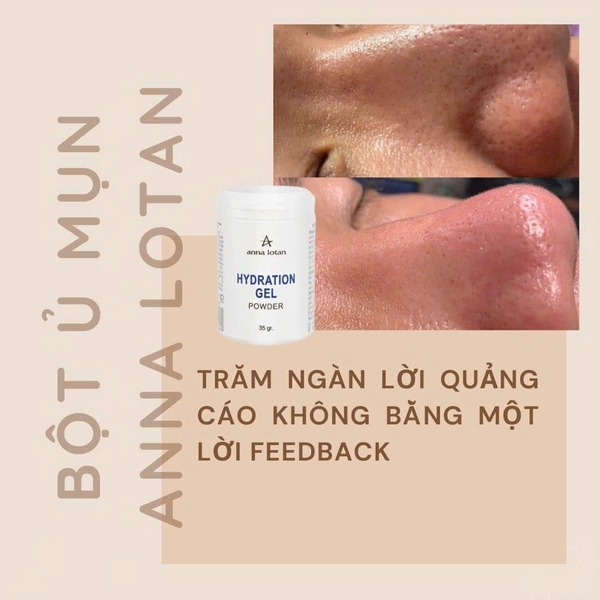 ANNA LOTAN HYDRATION GEL POWDER / BỘT Ủ MỤN