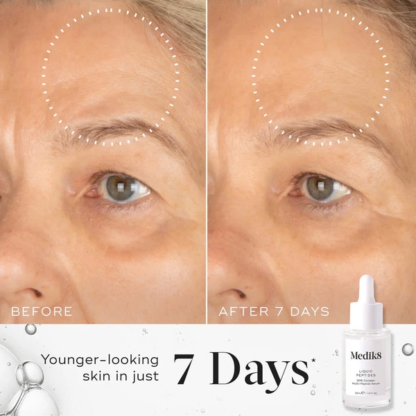 MEDIK8 LIQUID PEPTIDES 30% COMPLEX MULTI-PEPTIDE SERUM / HUYẾT THANH CHỐNG LÃO HOÁ 