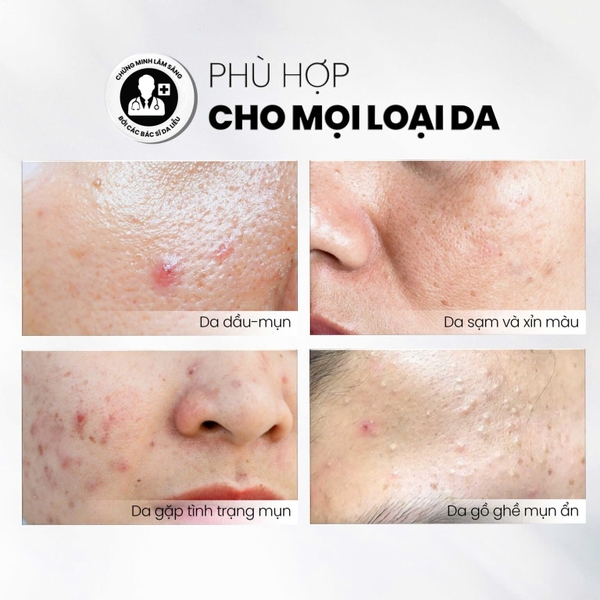 MDCARE ANTIAC EXFO / TẨY TẾ BÀO CHẾT KIỂM SOÁT MỤN, GIẢM VIÊM VÀ GIẢM TIẾT DẦU 