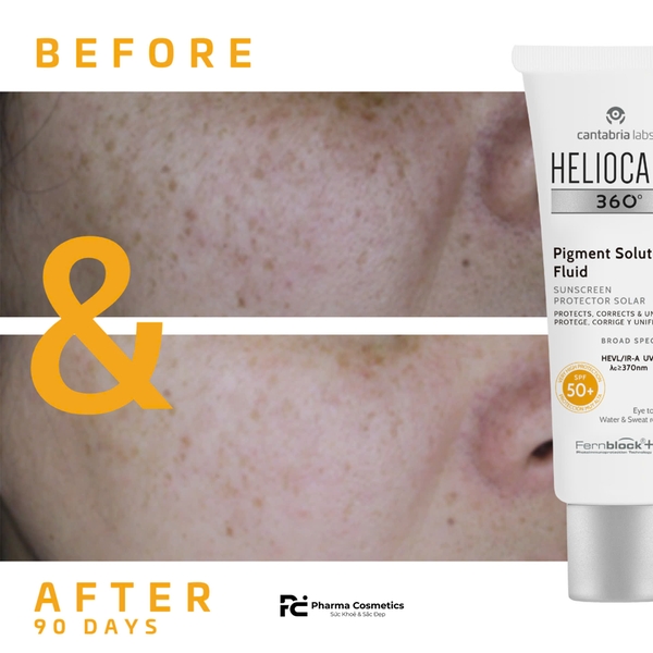 Heliocare 360° Pigment Solution Fluid SPF50+ – Kem Chống Nắng Ngừa Nám & Bảo Vệ Da Toàn Diện
