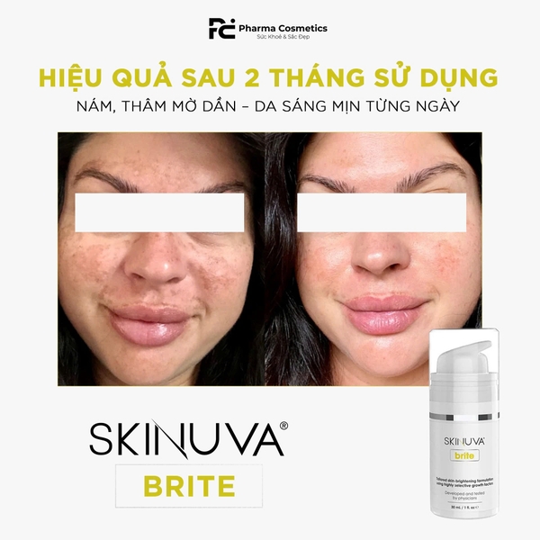 SKINUVA BRITE: Giải Pháp Toàn Diện Cho Làn Da Sáng Khỏe Rạng Rỡ