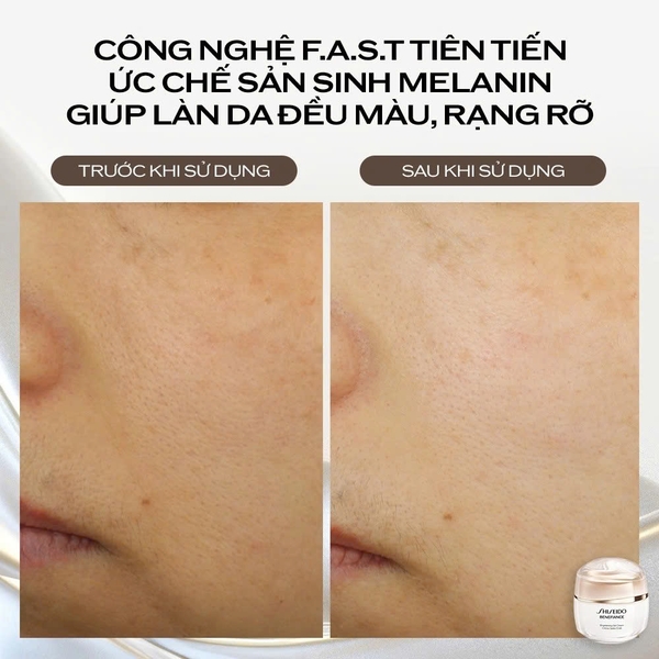 SHISEIDO BENEFIANCE BRIGHTENING GEL CREAM: Gel Dưỡng Trắng Sáng, Cải Thiện Da Không Đều Màu