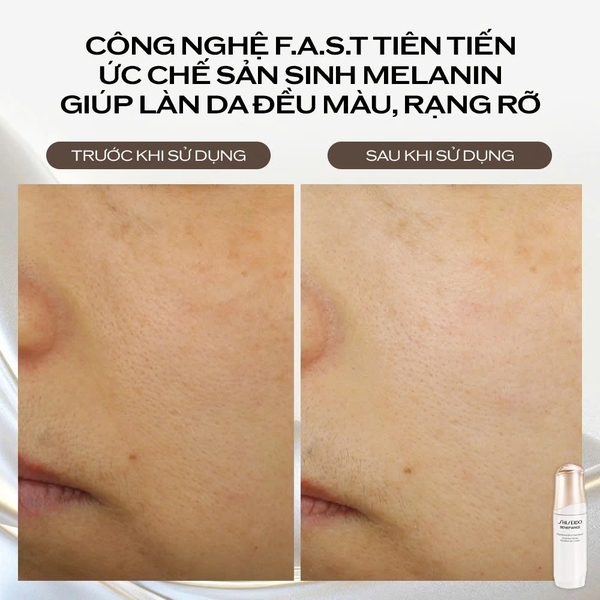 SHISEIDO BRIGHTENING MICRO-SPOT SERUM: Tinh Chất Làm Sáng Da, Mờ Đốm Nâu & Cải Thiện Tông Màu Da