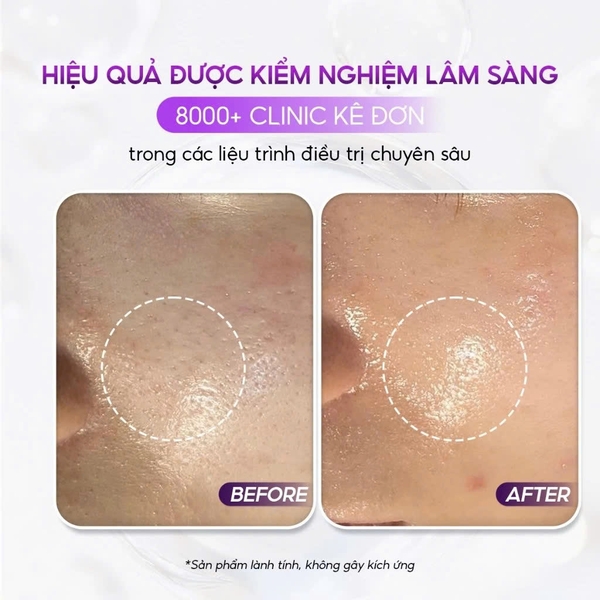 CONAPIDIL CEMENPHALT: Mặt Nạ Thạch Phục Hồi, Giúp Làn Da Nhạy Cảm Trở Nên Khỏe Mạnh