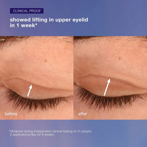 DERMALOGICA PHYTO NATURE LIFTING EYE CREAM: Kem Mắt Nâng Cơ & Săn Chắc, Cho Vùng Da Mắt Trẻ Trung