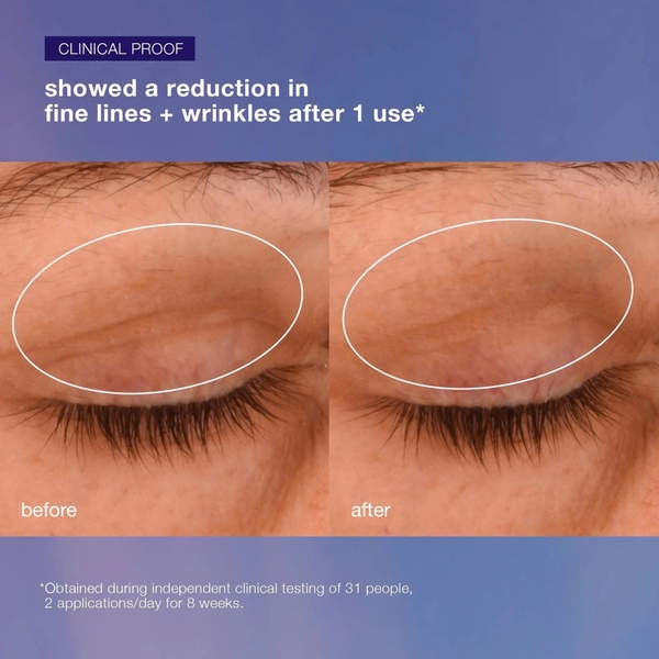 DERMALOGICA PHYTO NATURE LIFTING EYE CREAM: Kem Mắt Nâng Cơ & Săn Chắc, Cho Vùng Da Mắt Trẻ Trung