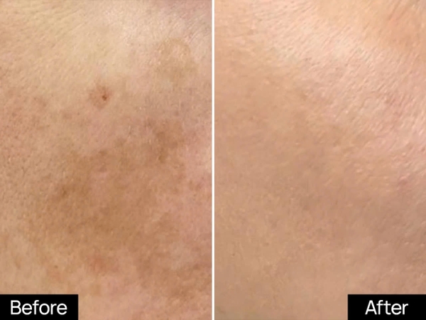 GSC MELA BRIGHT DAY SERUM: Tinh Chất Ban Ngày - Dưỡng Sáng & Ngăn Nám Tái Phát Toàn Diện