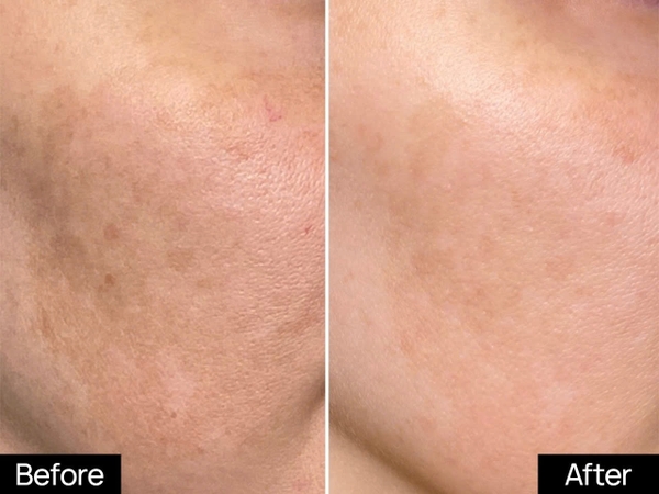 GSC MELA BRIGHT NIGHT SERUM: Tinh Chất Phục Hồi & Dưỡng Sáng, Mờ Nám Chuyên Sâu Ban Đêm