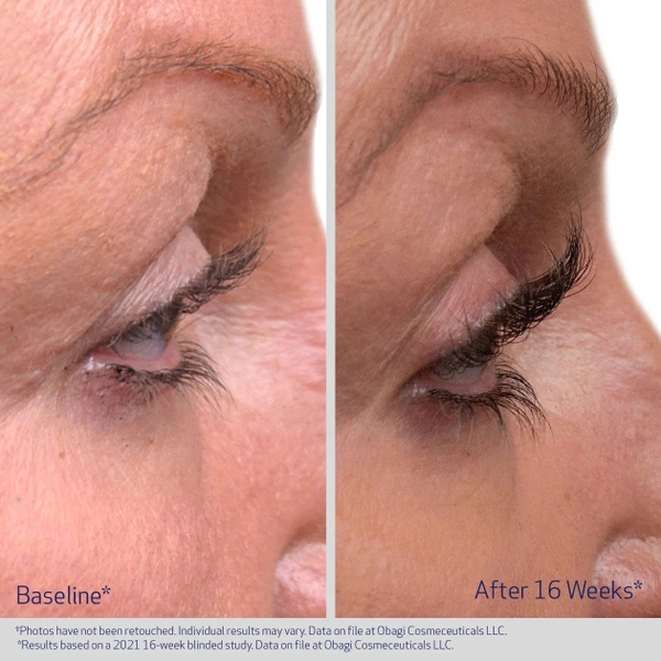 OBAGI NU-CIL EYELASH ENHANCING / TINH CHẤT DƯỠNG MI