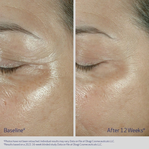 ​​​​​OBAGI ELASTIDERM® FIRMING EYE CREAM: Kem Dưỡng Mắt Tái Tạo Elastin – Đánh Tan Nếp Nhăn, Nâng Cơ & Trẻ Hóa Ánh Nhìn