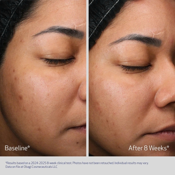 Obagi Medical Retinol + PHA Refining Night Cream: Kem Dưỡng Tái Tạo Da Chuyên Sâu, Làm Mịn Và Đều Màu Da Ban Đêm