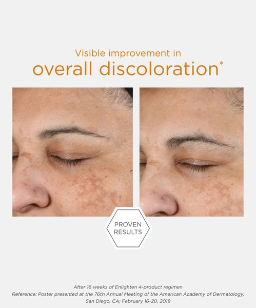 NEOSTRATA ENLIGHTEN Pigment Controller – Kem Dưỡng Hỗ Trợ Làm Mờ Đốm Nâu, Dưỡng Sáng Và Làm Đều Màu Da