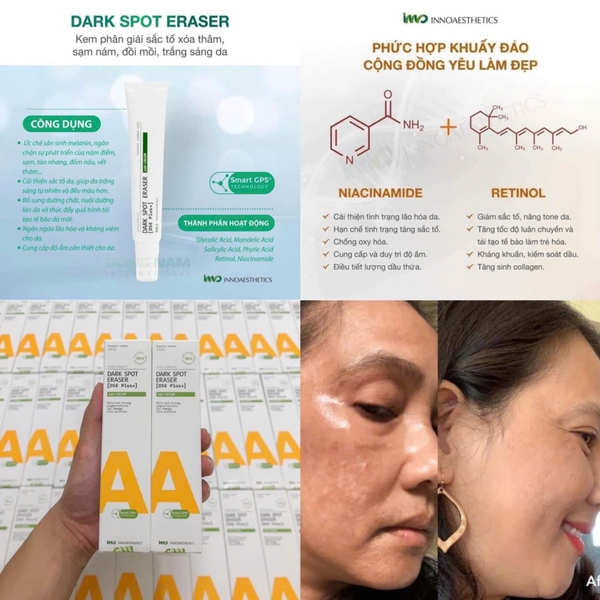 INNOAESTHETICS DARK SPOT ERASER [DSE Plus+] 24H CREAM: Giải Pháp Đặc Trị Nám, Sắc Tố & Trẻ Hóa Da Chuyên Sâu