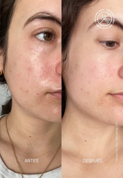 Transparent Barrier Restoring Hydrating Cream – Kem Dưỡng Ẩm Sâu, Củng Cố Hàng Rào Bảo Vệ Da Và Ngăn Ngừa Các Dấu Hiệu Tuổi Tác