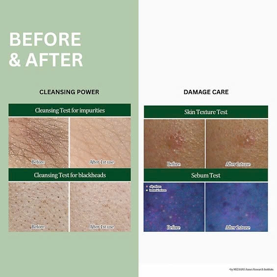 Histolab Azulene Calming Cleanser – Sữa Rửa Mặt Dạng Bọt Dịu Nhẹ, Làm Sạch Sâu Và Làm Dịu Làn Da Nhạy Cảm