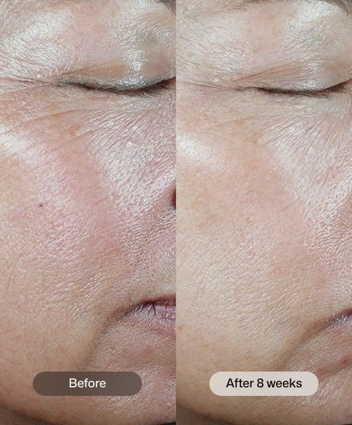 REVISION C+ Correcting Complex 30% – Tinh Chất Vitamin C Cao Cấp Chống Oxy Hoá Dưỡng Sáng, Làm Mều Màu 