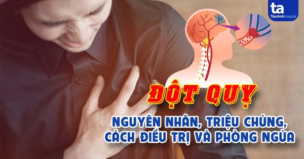 Các Biện Pháp Phòng Chống Đột Quỵ.