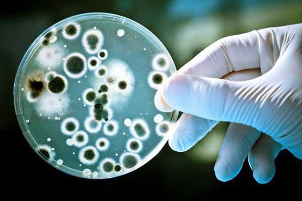nuôi cấy vi sinh vật trong đĩa petri