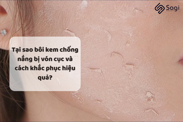 Tại sao bôi kem chống nắng bị vón cục và cách khắc phục hiệu quả?