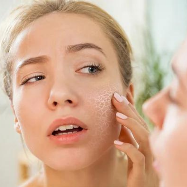 Chăm sóc da mùa hanh khô