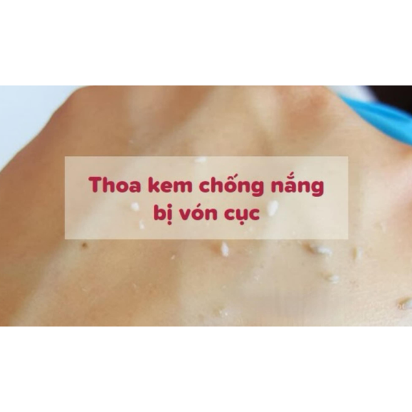Vì sao thoa kem chống nắng bị vón???
