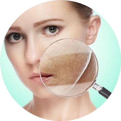 DỊ ỨNG MỸ PHẨM