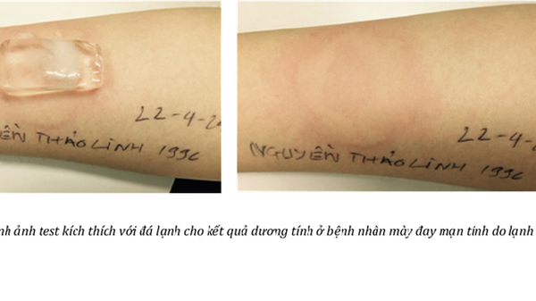 MÀY ĐAY MẠN TÍNH DO LẠNH DỄ MÀ KHÓ