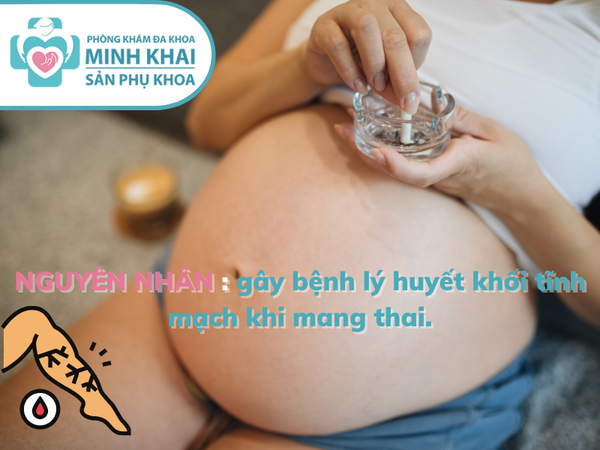 huyết khối tĩnh mạch khi mang thai lần đầu