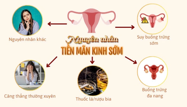Hình ảnh bài viết